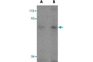 Western blot analysis of TICAM1 in human lung tissue lysates with TICAM1 polyclonal antibody  at (A) 2 and (B) 4 ug/mL .
