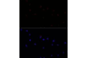 Immunofluorescence analysis of L929 cells using C antibody (ABIN7266034) at dilution of 1:100. (Calpain 7 抗体  (AA 20-220))
