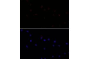Immunofluorescence analysis of L929 cells using C antibody (ABIN7266034) at dilution of 1:100. (Calpain 7 抗体  (AA 20-220))