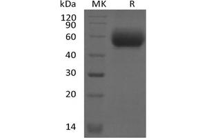 Western Blotting (WB) image for Interleukin 1 Receptor-Like 2 (IL1RL2) protein (His tag) (ABIN7320889) (IL1RL2 Protein (His tag))