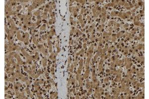 ABIN6278308 at 1/100 staining Human liver tissue by IHC-P. (IL-33 抗体  (Internal Region))