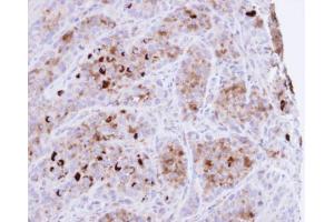 IHC-P Image Immunohistochemical analysis of paraffin-embedded A549 xenograft , using CRHSP-24, antibody at 1:100 dilution. (CARHSP1 抗体)