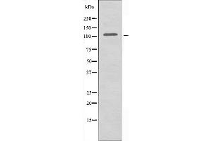 Western blot analysis of extracts from HeLa cells using AASS antibody. (AASS 抗体  (C-Term))