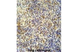 Immunohistochemistry (IHC) image for anti-KRI1 Homolog (KRI1) antibody (ABIN2995581) (KRI1 抗体)