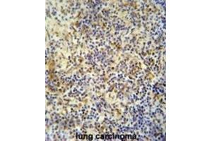 Immunohistochemistry (IHC) image for anti-KRI1 Homolog (KRI1) antibody (ABIN5015220) (KRI1 抗体)