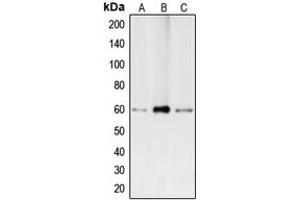 Western blot analysis of BMP2 expression in Caco2 (A), HepG2 (B), THP1 (C) whole cell lysates. (BMP2 抗体  (Center))