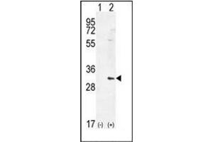 Western blot analysis of HMOX1 (arrow) using Heme oxygenase 1 / HMOX1 Antibody (Center) Cat. (HMOX1 抗体  (Middle Region))