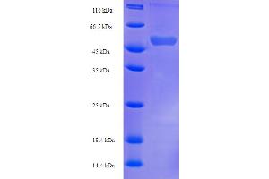 Ferredoxin Reductase (FDXR) (AA 33-451) protein (His-SUMO Tag)
