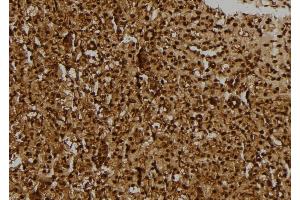 ABIN6275163 at 1/100 staining Rat kidney tissue by IHC-P. (GIDRP88 抗体  (C-Term))