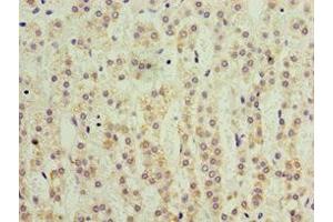 Immunohistochemistry of paraffin-embedded human adrenal gland tissue using ABIN7157726 at dilution of 1:100 (KLF3 抗体  (AA 1-240))
