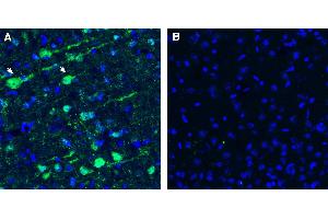 Expression of GPR173 in rat parietal cortexImmunohistochemical staining of perfusion-fixed frozen rat brain sections with Anti-GPR173 Antibody (ABIN7581888), (1:200), followed by goat anti-rabbit-AlexaFluor-488.