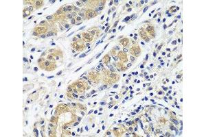 Immunohistochemistry of paraffin-embedded Human stomach using GPRC5A Polyclonal Antibody at dilution of 1:100 (40x lens). (GPRC5A 抗体)