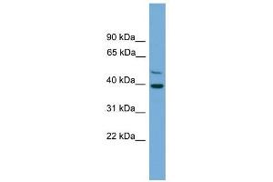 C21orf58 antibody used at 1 ug/ml to detect target protein. (C21orf58 抗体  (N-Term))