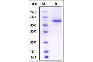Rat LAG3, His Tag on SDS-PAGE under reducing (R) condition. (LAG3 Protein (AA 24-442) (His tag))