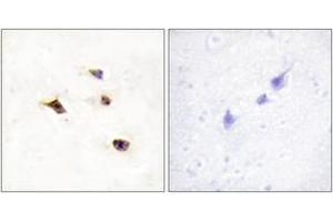 Immunohistochemistry analysis of paraffin-embedded human brain tissue, using IP6K3 Antibody. (IP6K3 抗体  (AA 201-250))