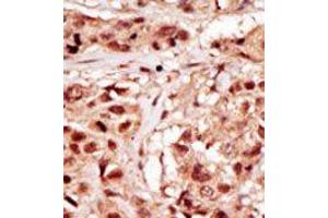 Image no. 2 for anti-TP53 Regulating Kinase (TP53RK) (Middle Region) antibody (ABIN360571) (TP53RK 抗体  (Middle Region))
