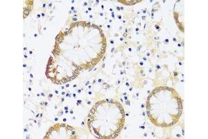 Immunohistochemistry of paraffin-embedded Human stomach using CAMK1 Polyclonal Antibody at dilution of 1:100 (40x lens). (CAMK1 抗体)