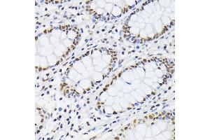 Immunohistochemistry (IHC) image for anti-Polypyrimidine Tract Binding Protein 1 (PTBP1) (AA 1-290) antibody (ABIN3022618)