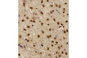 Immunohistochemical analysis of paraffin-embedded R. (NEK2 抗体  (AA 396-426))