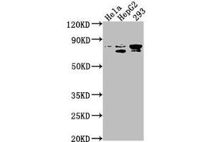 Western Blot Positive WB detected in: Hela whole cell lysate, HepG2 whole cell lysate, 293 whole cell lysate All lanes: SRPK2 antibody at 1:1000 Secondary Goat polyclonal to rabbit IgG at 1/50000 dilution Predicted band size: 78, 80 kDa Observed band size: 78 kDa (SRPK2 抗体  (AA 471-688))