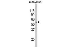 Image no. 1 for anti-Regulator of Chromosome Condensation (RCC1) and BTB (POZ) Domain Containing Protein 2 (RCBTB2) (N-Term) antibody (ABIN452843)