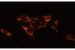 Immunofluorescence analysis of C6 cells using ADORA2A Polyclonal Antibody at dilution of 1:100.