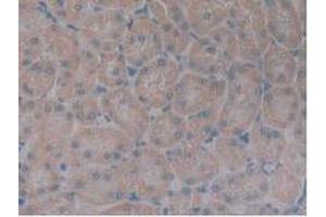 IHC-P analysis of Rat Kidney Tissue, with DAB staining. (Growth Hormone Receptor 抗体  (AA 353-588))