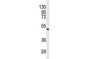 Western blot analysis of ANGPTL6 antibody and K562 lysate. (ANGPTL6 抗体  (AA 206-236))