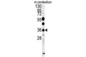 Western Blotting (WB) image for anti-OTU Domain Containing 6B (OTUD6B) antibody (ABIN3002448) (OTUD6B 抗体)