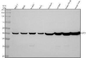 Western blot analysis of GOT1 using anti-GOT1 antibody (ABIN7604046).
