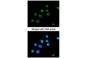 Immunofluorescence (IF) image for anti-Paired Box 8 (PAX8) antibody (ABIN2855097)