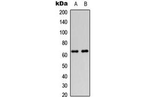 Western blot analysis of DGK epsilon expression in HeLa (A), HEK293T (B) whole cell lysates. (DGKE 抗体  (Center))