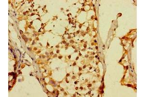 Immunohistochemistry of paraffin-embedded human testis tissue using ABIN7150619 at dilution of 1: 100 (DUX4 抗体  (AA 217-402))