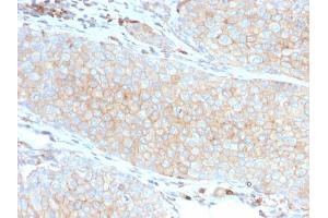 Immunohistochemistry (IHC) image for anti-CD274 (PD-L1) (AA 39-191) antibody (ABIN6939571)
