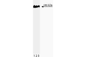 Western blot analysis of 53BP1 on a HeLa lysate. (TP53BP1 抗体  (AA 149-259))