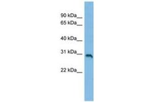 SLC35E2 antibody  (C-Term)