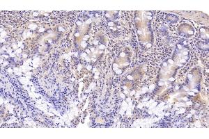 Detection of DNAH11 in Human Small intestine Tissue using Monoclonal Antibody to Dynein, Axonemal, Heavy Chain 11 (DNAH11) (DNAH11 抗体  (AA 3896-4122))