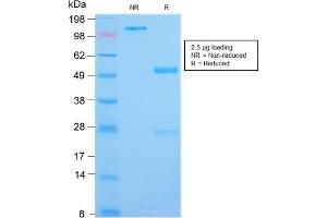 SDS-PAGE Analysis Purified IL3RA Rabbit Recombinant Monoclonal Antibody (IL3RA/2947R). (Recombinant IL3RA 抗体  (AA 26-171))