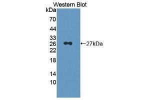 Western Blotting (WB) image for anti-Prostaglandin D2 Synthase (PTGDS) (AA 1-199) antibody (ABIN1870061) (PTGDS 抗体  (AA 1-199))