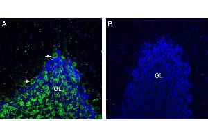 Expression of Neuroligin-3 in rat cerebellum. (Neuroligin 3 抗体  (Extracellular, N-Term))