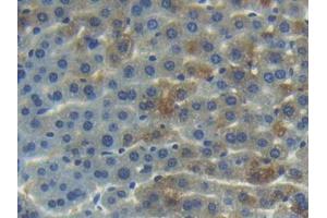 IHC-P analysis of Mouse Liver Tissue, with DAB staining. (ANG 抗体  (AA 25-145))