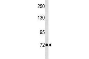 TBR2 antibody western blot analysis in A375 lysate. (EOMES 抗体  (AA 28-57))