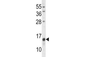 Osteocalcin antibody western blot analysis in U251 lysate. (Osteocalcin 抗体  (AA 2-32))