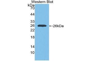 Western blot analysis of the recombinant protein. (IGF1R 抗体  (AA 763-955))