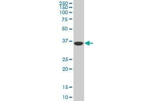 Western Blotting (WB) image for anti-PDZ Binding Kinase (PBK) (AA 1-110) antibody (ABIN599274) (PBK 抗体  (AA 1-110))