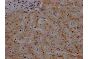 IHC image of ABIN7127393 diluted at 1:100 and staining in paraffin-embedded human liver tissue performed on a Leica BondTM system. (Recombinant CD13 抗体)