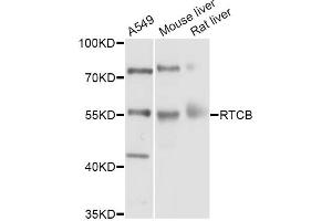 Western blot analysis of extracts of various cell lines, using RTCB Antibody (ABIN5998730) at 1/1000 dilution. (C22orf28 抗体)