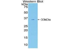 Western Blotting (WB) image for anti-GRB2-Associated Binding Protein 3 (GAB3) (AA 332-583) antibody (ABIN1858939) (GAB3 抗体  (AA 332-583))