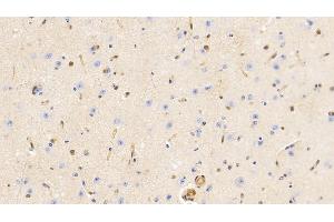 Detection of GSN in Bovine Cerebrum Tissue using Monoclonal Antibody to Gelsolin (GSN) (Gelsolin 抗体  (AA 170-423))