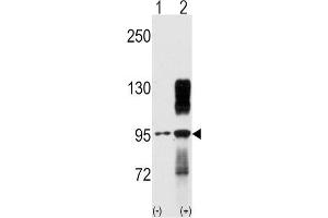 Western blot analysis of TYRO10 (arrow) using rabbit polyclonal TYRO10 Antibody. (DDR2 抗体)